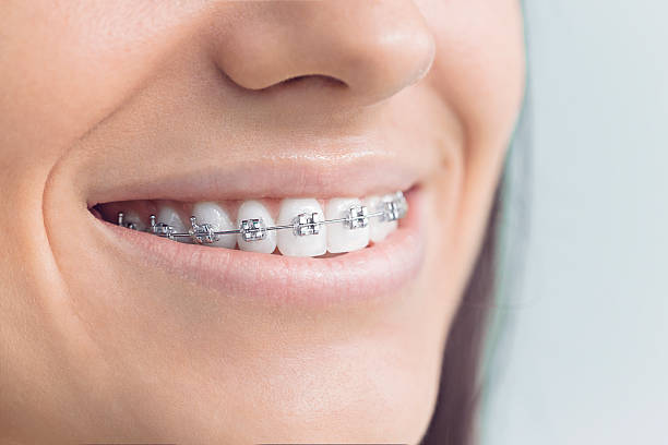 Best Invisalign and Clear Aligners  in Mableton, GA
